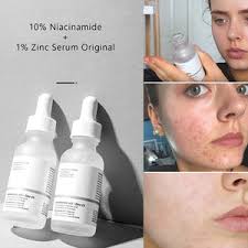 The Ordinary Niacinamide 10% + Zinc 1% – 30ml (100%) Orignal | Free Shipping | Cash on Delivery